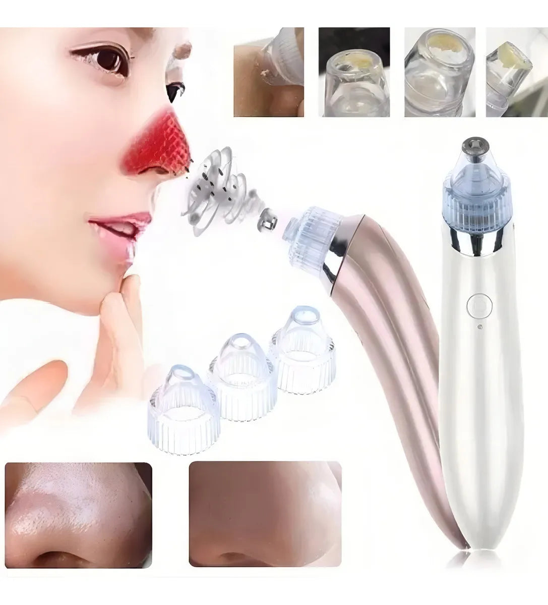 Máquina Eléctrica para eliminar puntos negros y acné